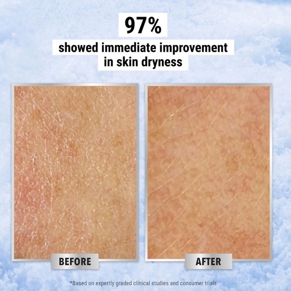 LAST 1! Kiehls Ultra Facial Cream Moisturizer Mini🪞 NEW Bestseller - Picture 5 of 9